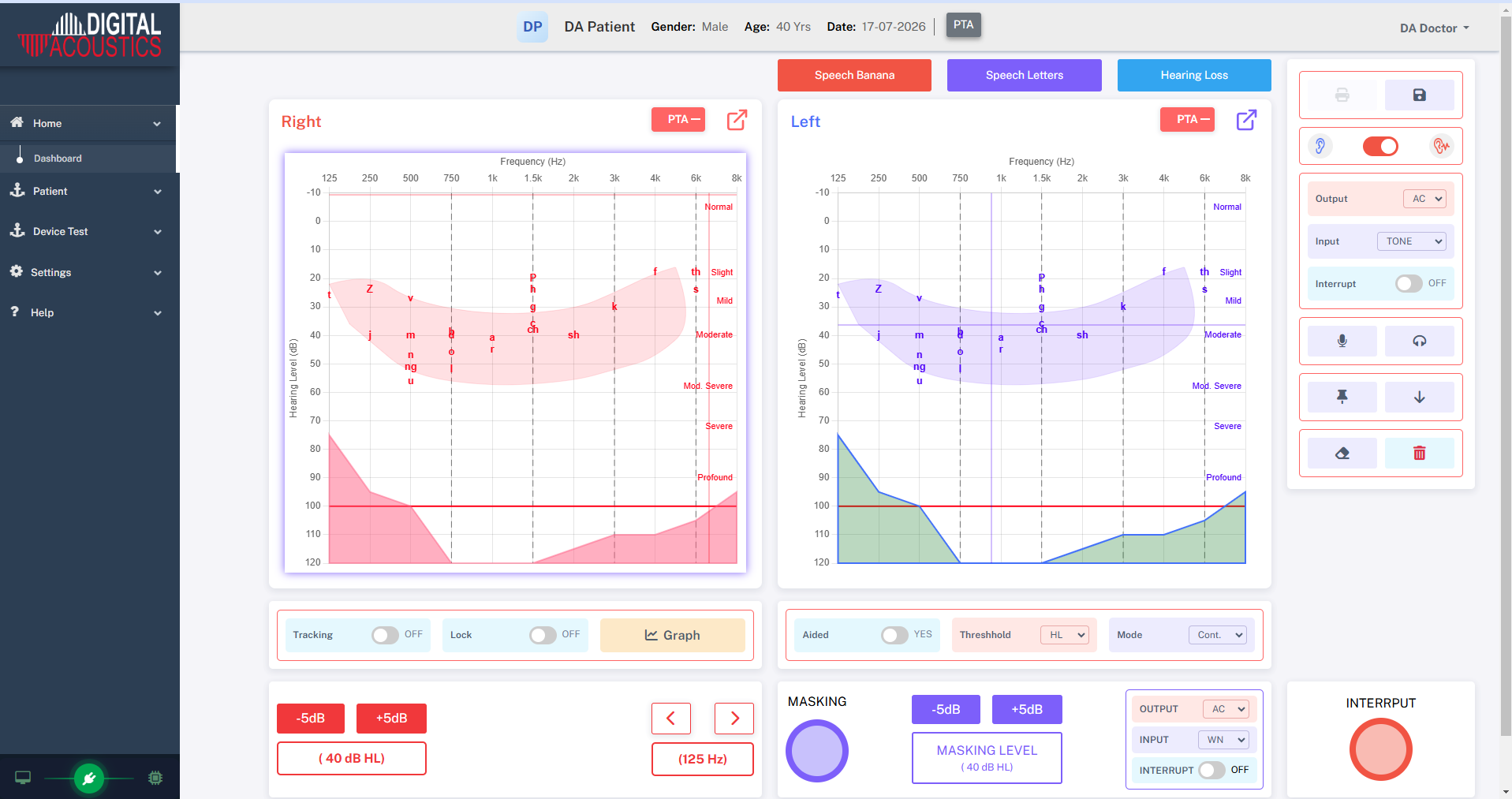 Audiogram
